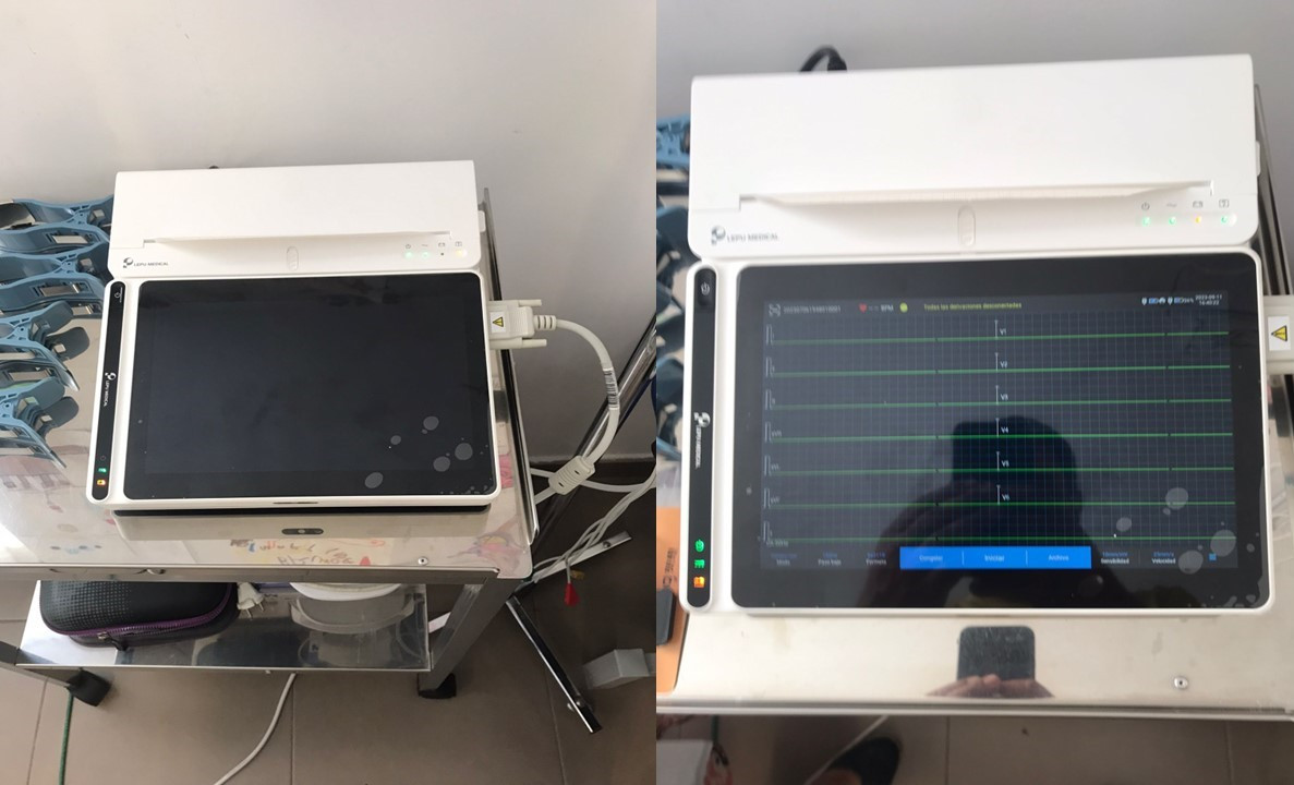 Electrocardiograma prioro 3